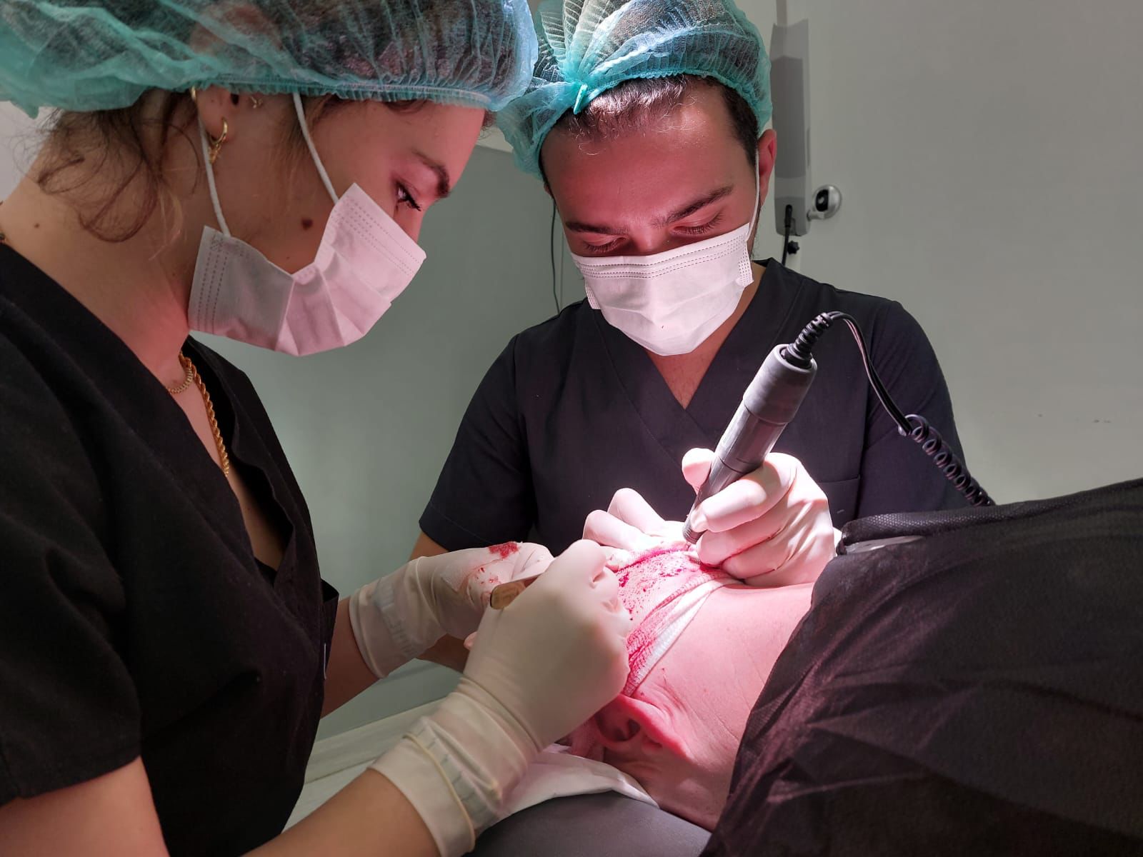 behandelingen-hoe-werkt-een-haartransplantatie Hoe werkt een haartransplantatie?
